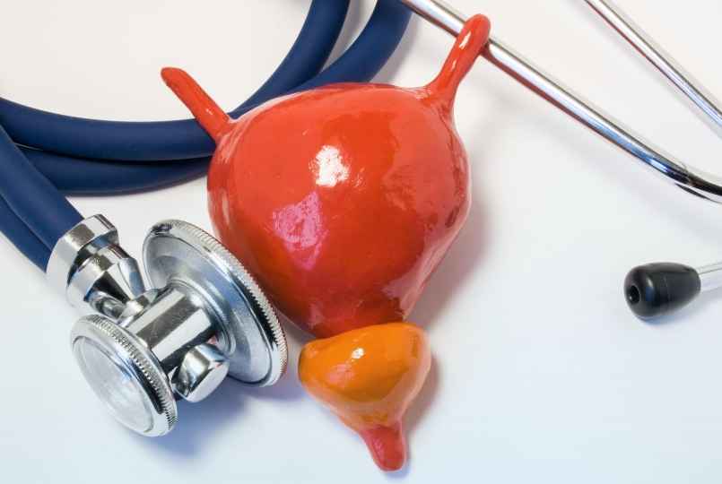 Aumento Benigno da Próstata (Hiperplasia Prostática Benigna – HPB)