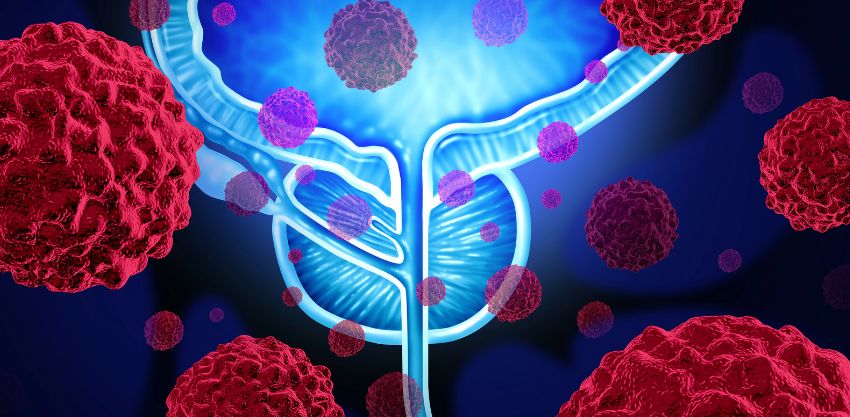 Novembro Azul: Atenção aos Sinais do Câncer de Próstata